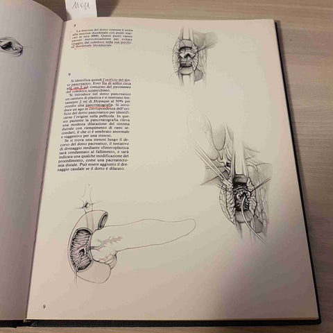 TECNICHE CHIRURGICHE ILLUSTRATE VOL. 2 NO. 4 - PANCREATITE CRONICA -VERDUCI-1979
