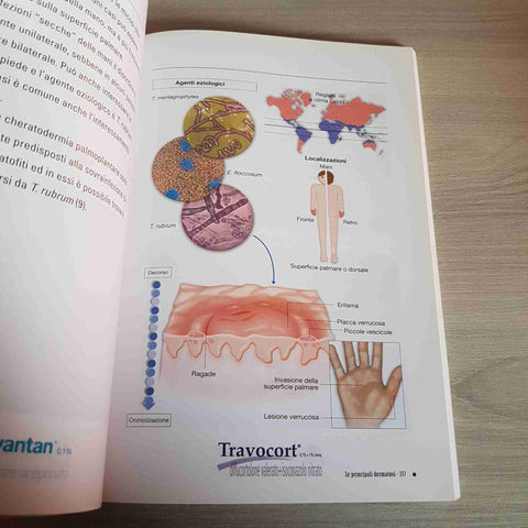 LE PRINCIPALI DERMATOSI - MINIATLAS - 2011