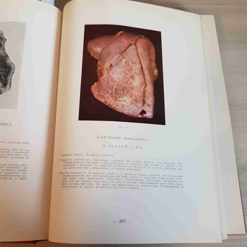 ANATOMIA PATOLOGICA DELL'UOMO - CESARE CIONI, PALAZZI - AMBROSIANA - 1949