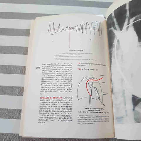 DIZIONARIO DELLE MALATTIE CARDIOVASCOLARI - MARRAPESE - 1978 delamare