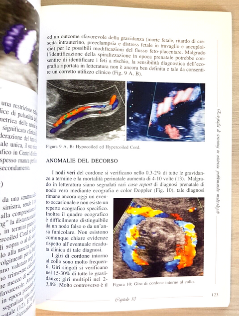 ECOGRAFIA DI SCREENING IN OSTETRICIA: PROBLEMATICHE MEDICO LEGALI 2009 sieog7666