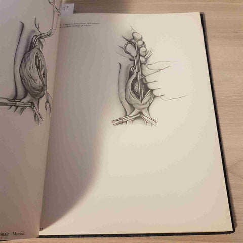 TECNICHE CHIRURGICHE ILLUSTRATE VOL. 2 NO. 1 - ANEURISMA AORTA ASCELLA - VERDUCI