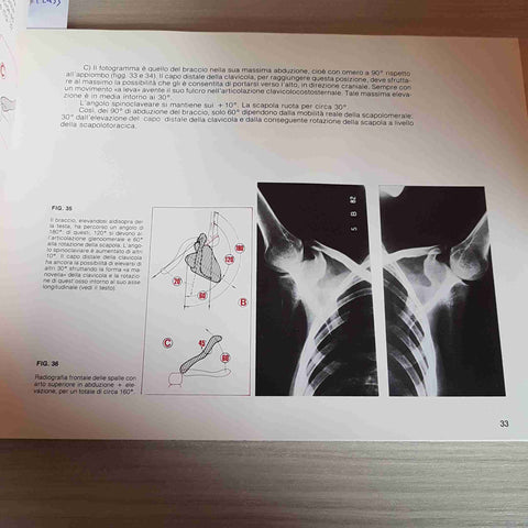 SEMEIOTICA E PATOLOGIA REUMATICA DELLE ARTICOLAZIONI STERNALI - PELLEGRINI