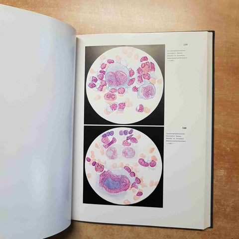 HEILMEYER - ATLAS DER KLINISCHEN HAMATOLOGIE UND CYTOLOGIE textband + bildband