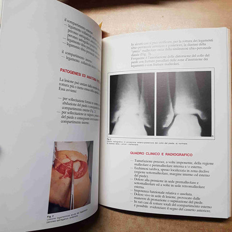 PATOLOGIA DA SPORT tendinopatie fratture distorsioni CONCEPTA 1980 ANGELINI