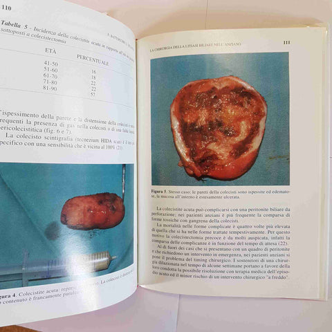 LA LITIASI BILIARE NELL ANZIANO PILOTTO DEL FAVERO DI MARIO PICCIN MEDICO 1994