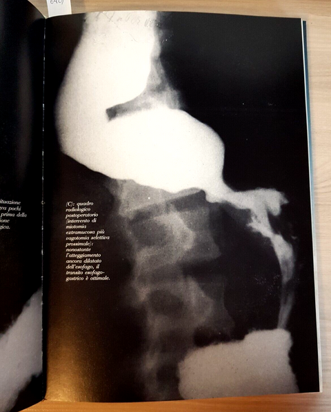LE MALATTIE DELL'ESOFAGO E DEL GIUNTO ESOFAGOGASTRICO - Galliera 1990 USES