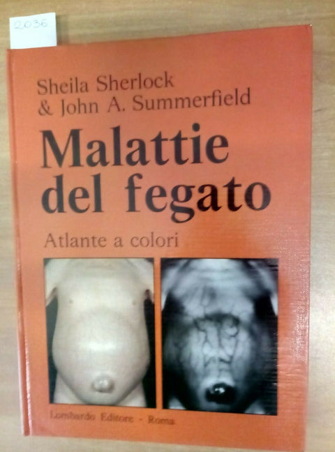 MALATTIE DEL FEGATO - ATLANTE A COLORI - SHERLOCK 1981 LOMBARDO (2036)