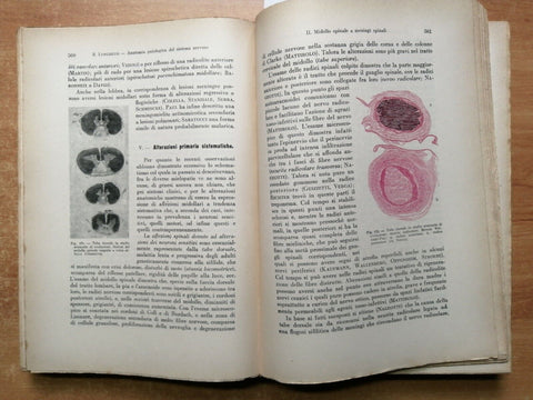 MEDICINA 1945 Trattato italiano di anatomia patologica - vol. 2 - UTET (70