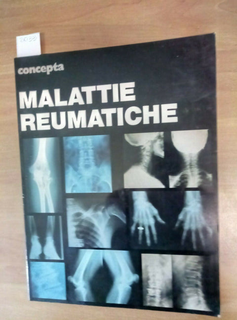 MALATTIE REUMATICHE - MICCOLI LANZARINI 1977 ANGELINI CONCEPTA (2033)
