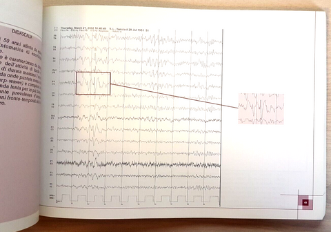 Glossario Illustrato di EEGrafia - Sasanelli - Medical Communications 2004
