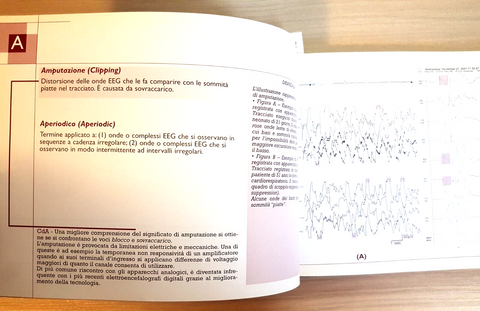 Glossario Illustrato di EEGrafia - Sasanelli - Medical Communications 2004