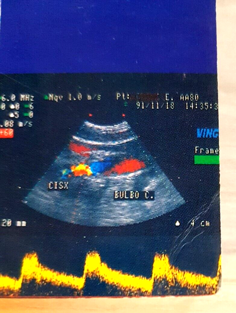 La diagnostica strumentale nella insufficienza cerebro-vascolare - COPPI (7