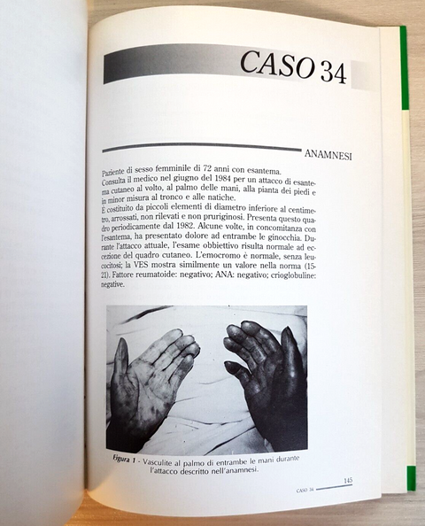 CASI CLINICI REUMATOLOGIA - MANUEL SERRANO MARTINEZ - 40 casi 1994 MASSON (