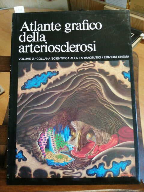 ATLANTE GRAFICO DELLA ARTERIOSCLEROSI volume 2 - Skema - Alfa Farmaceutici