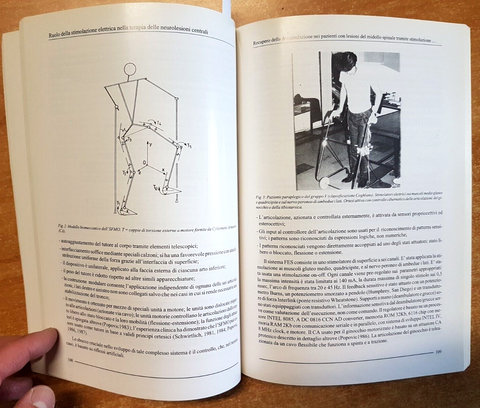LA STIMOLAZIONE ELETTRICA TERAPEUTICA NEL TRATTAMENTO NEUROLESIONI SCOLIOSI
