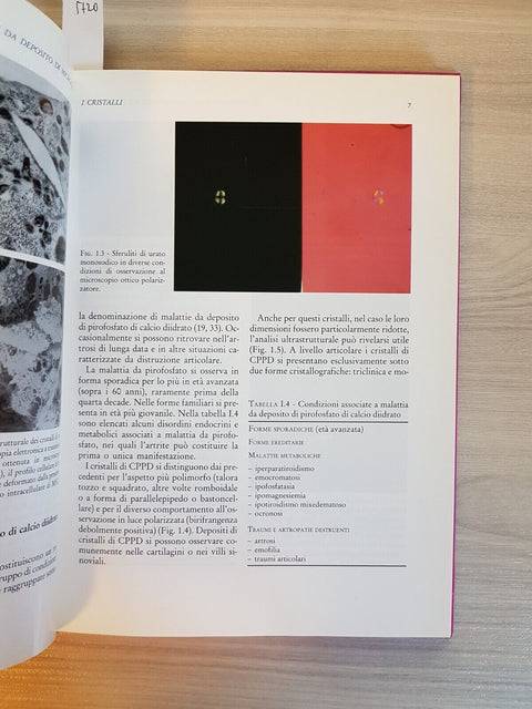 LE ARTROPATIE DA DEPOSITO DI MICROCRISTALLI E MALATTIE CORRELATE - GNOCCHI