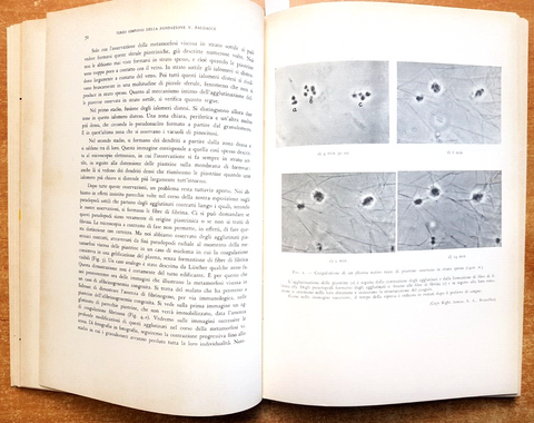 QUADERNI DELLA COAGULAZIONE 10 emostasi trombosi OMNIA MEDICA 1960 BALDACCI5913B