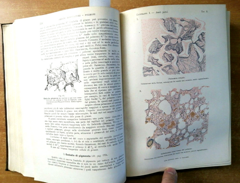 TRATTATO DI ANATOMIA PATOLOGICA SPECIALE parte 1 - KAUFMANN 1929 VALLARDI 1030K