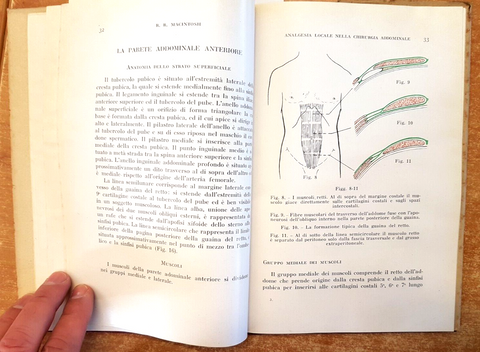 ANALGESIA LOCALE NELLA CHIRURGIA ADDOMINALE - MACINTOSH - 1954 illustrato (